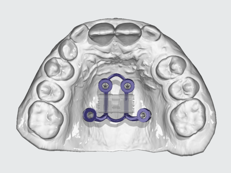 4x TAD Expander
