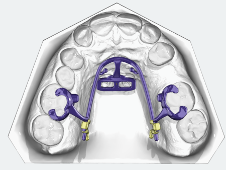 Mesial-Slider