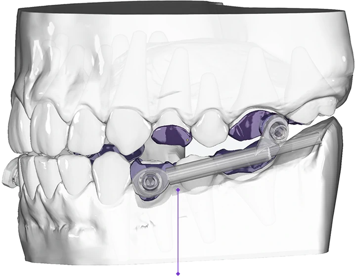 model-tooth-shop